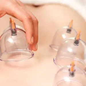 cupping